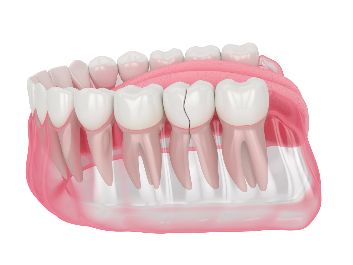 Urgent Dental Appointment