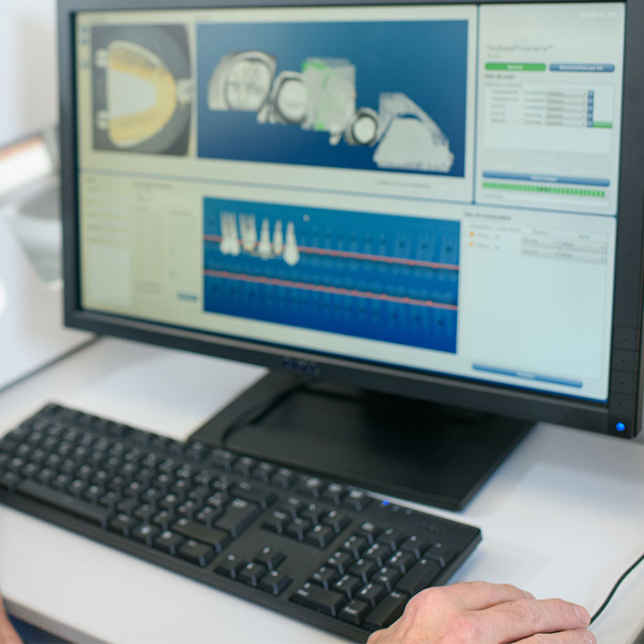 Paperless Teeth Charting in Cypress