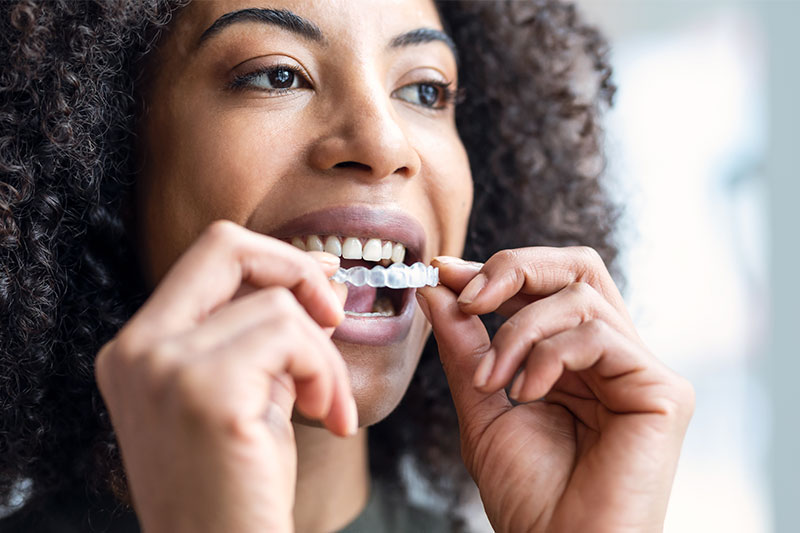 Orthodontic Treatments in Cypress