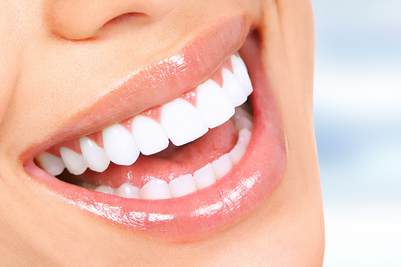 Mirabella Smiles Special Offer