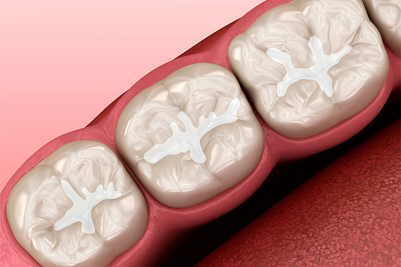 Sealants in Cypress
