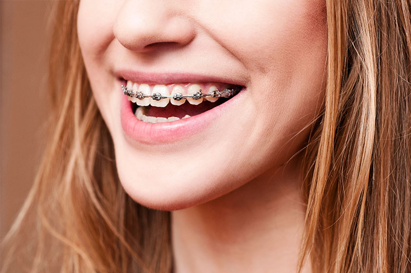 Propel Orthodontics in Cypress