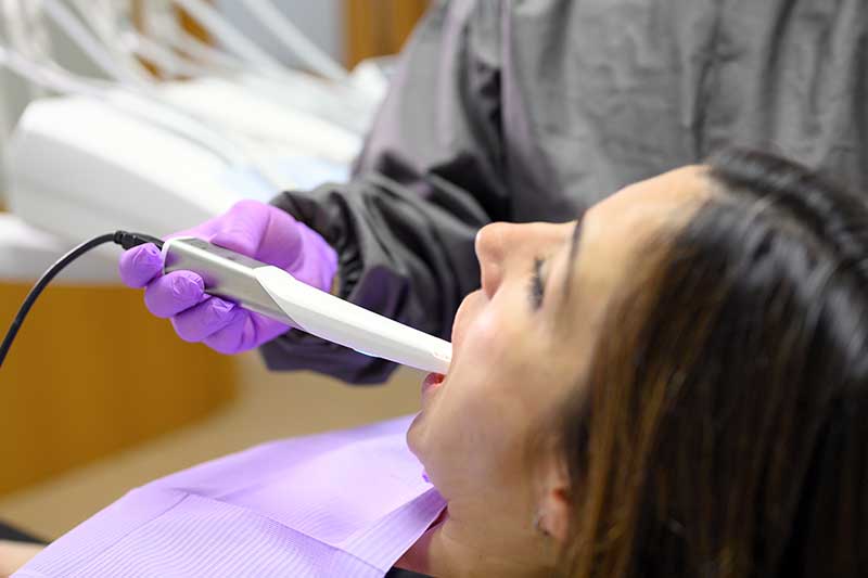 Intra-Oral Camera in Cypress